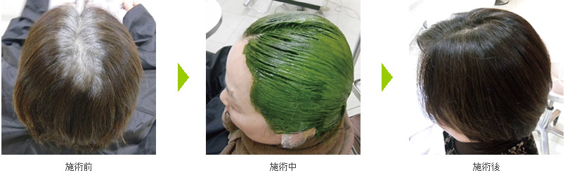 Before&After