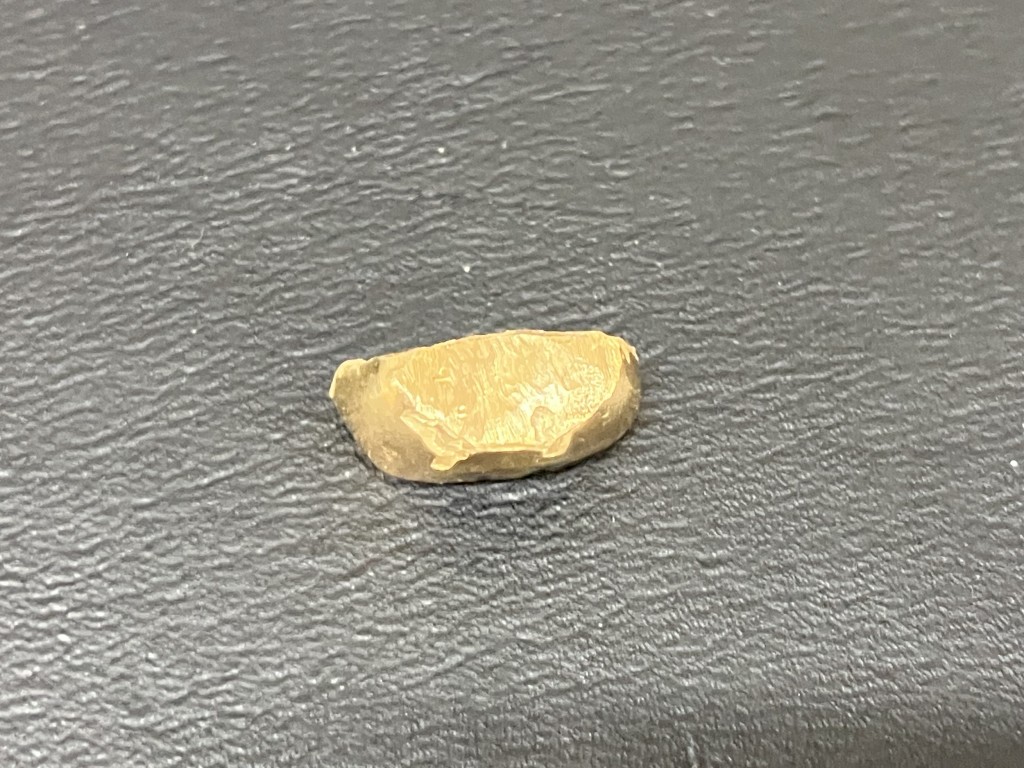 金歯買取/おたからや箕面店/金買取/プラチナ買取/遺品整理/箕面市/池田市/豊中市のお客様